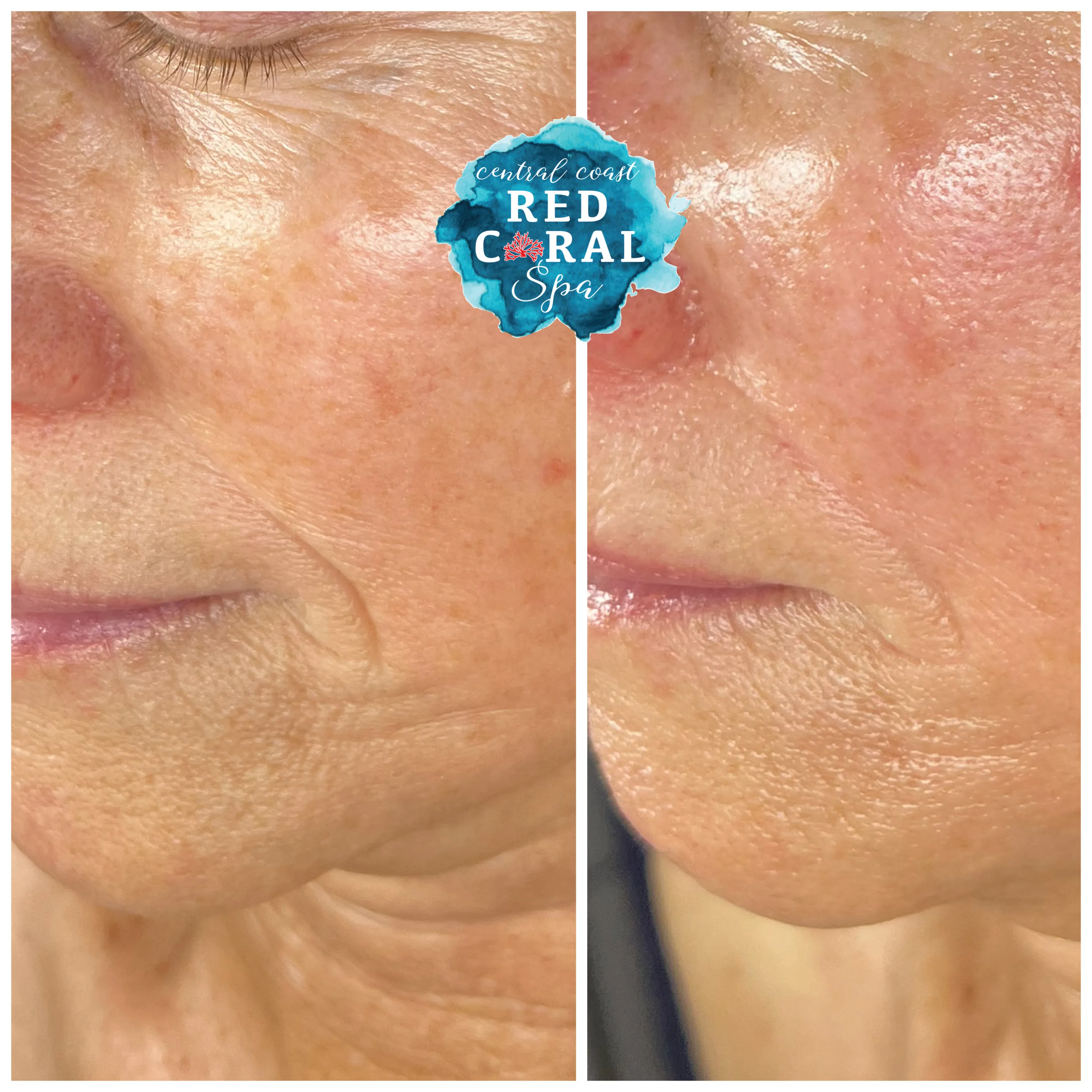 Before and after skin care results