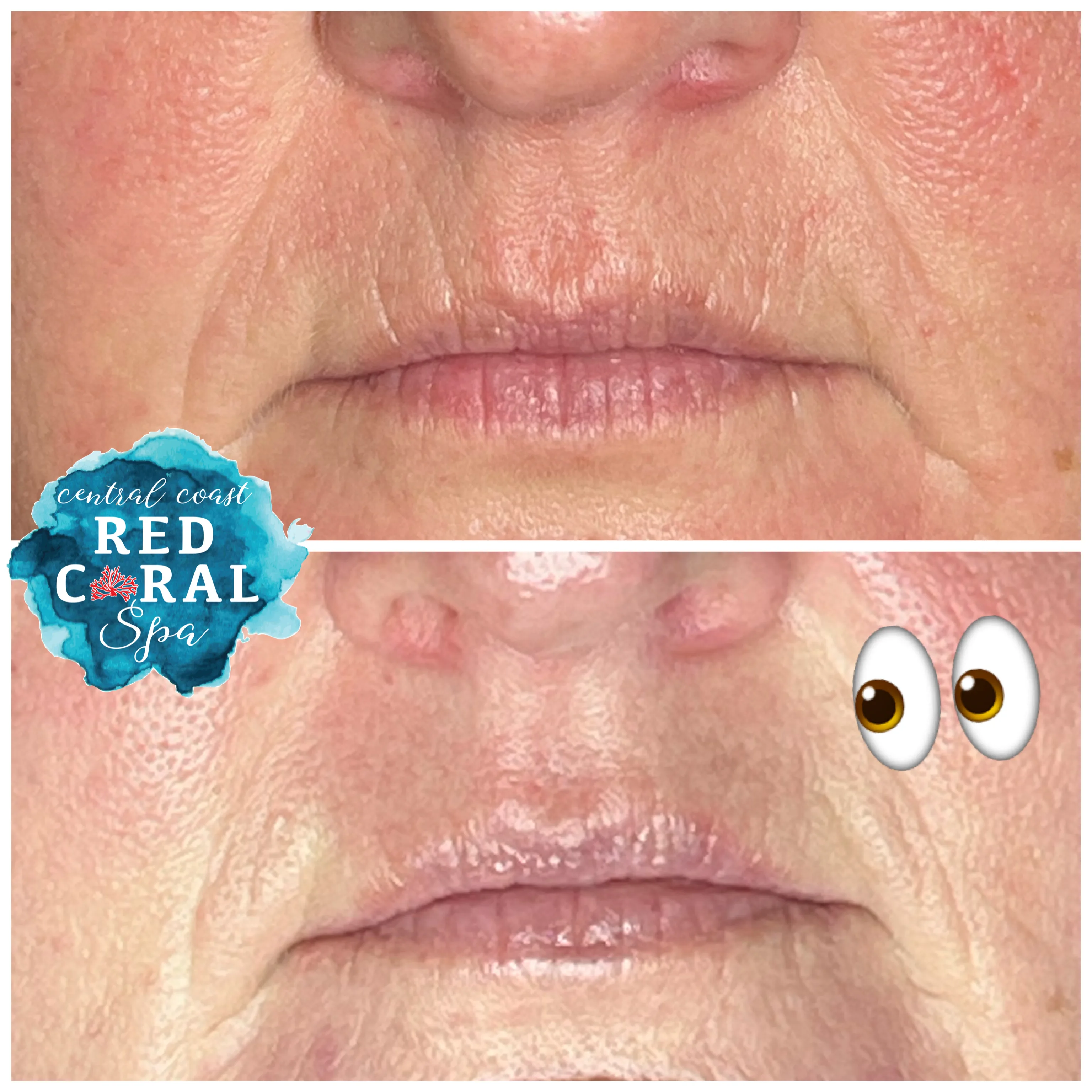 Before and after skin care results