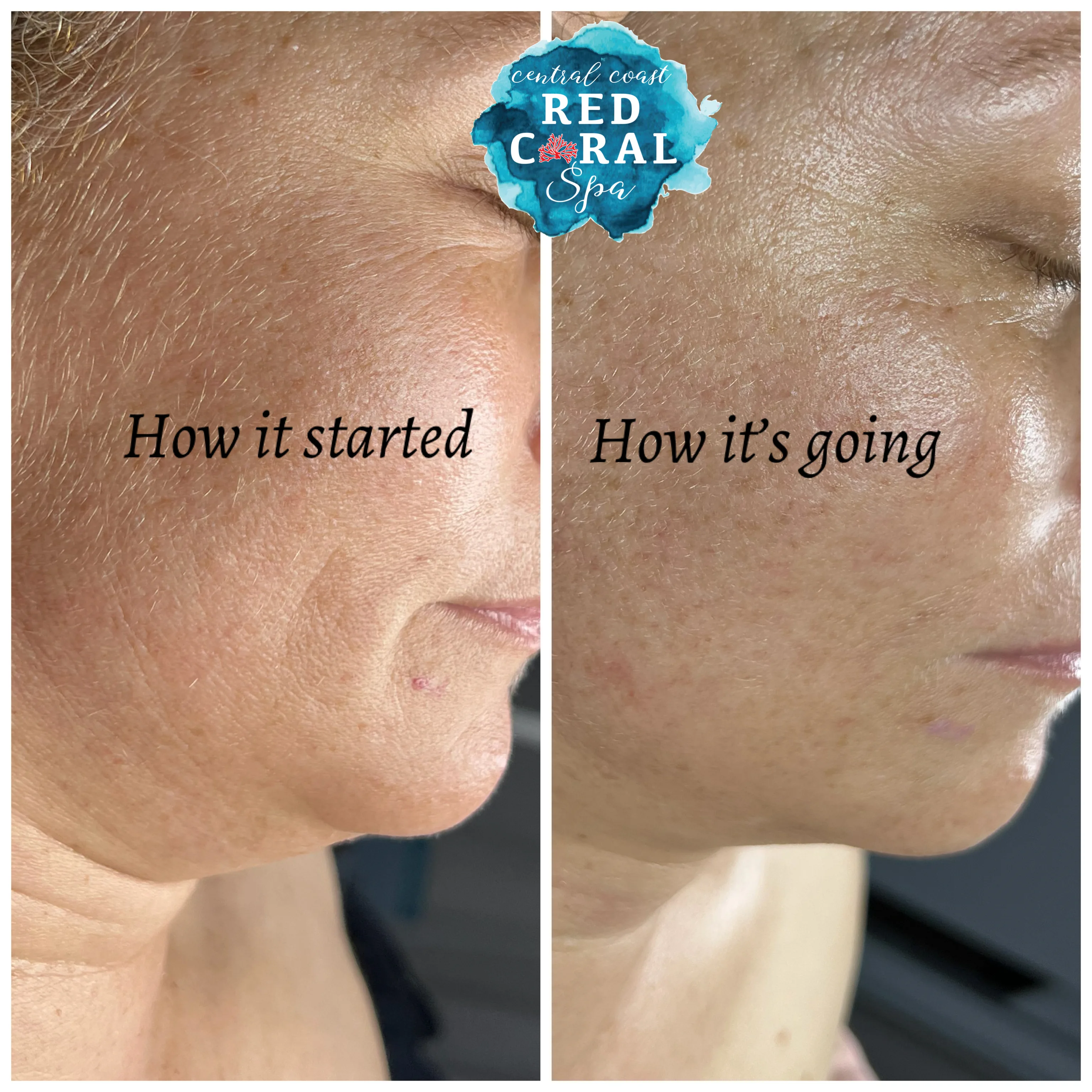 Before and after skin care results