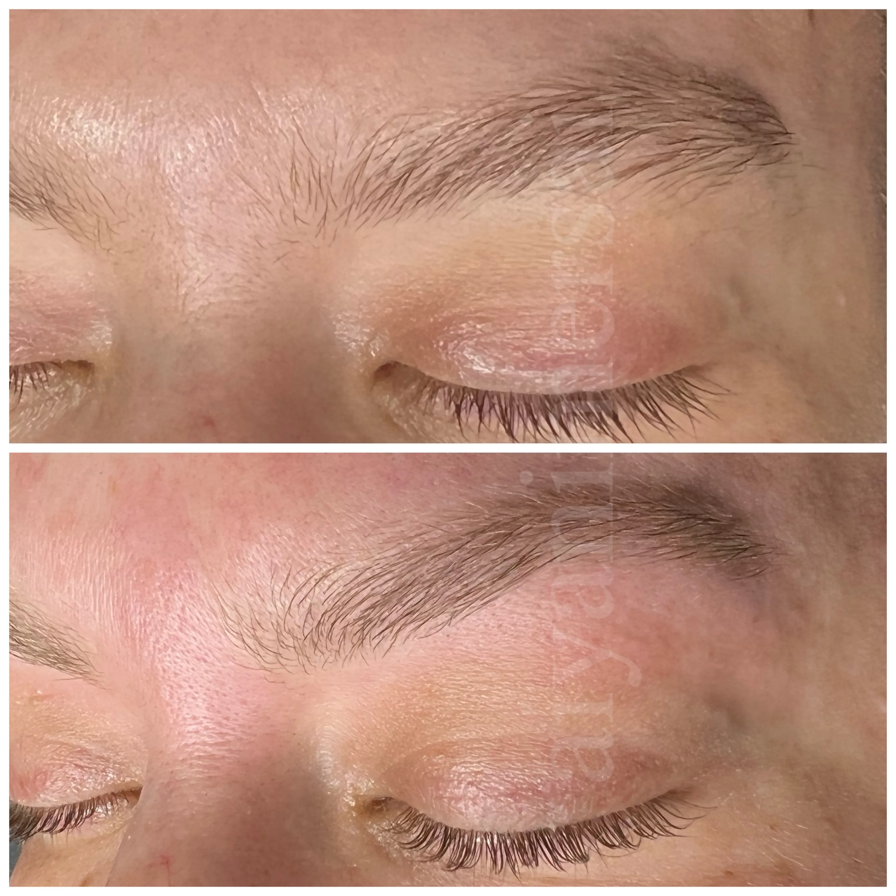 Before and after sugaring treatment results
